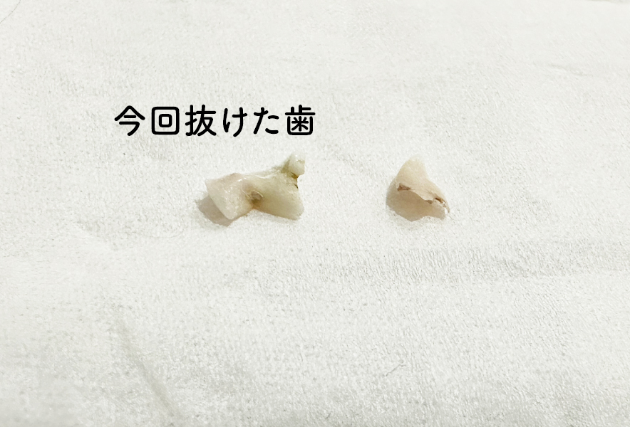 【ばんちゃん日記23】乳歯が抜けるのも大変だ！